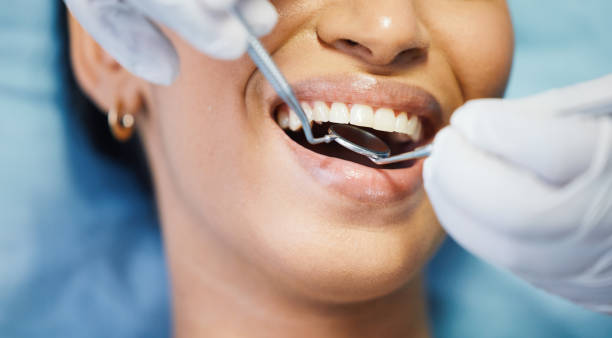 Best Emergency Tooth Extraction in Lombard, IL